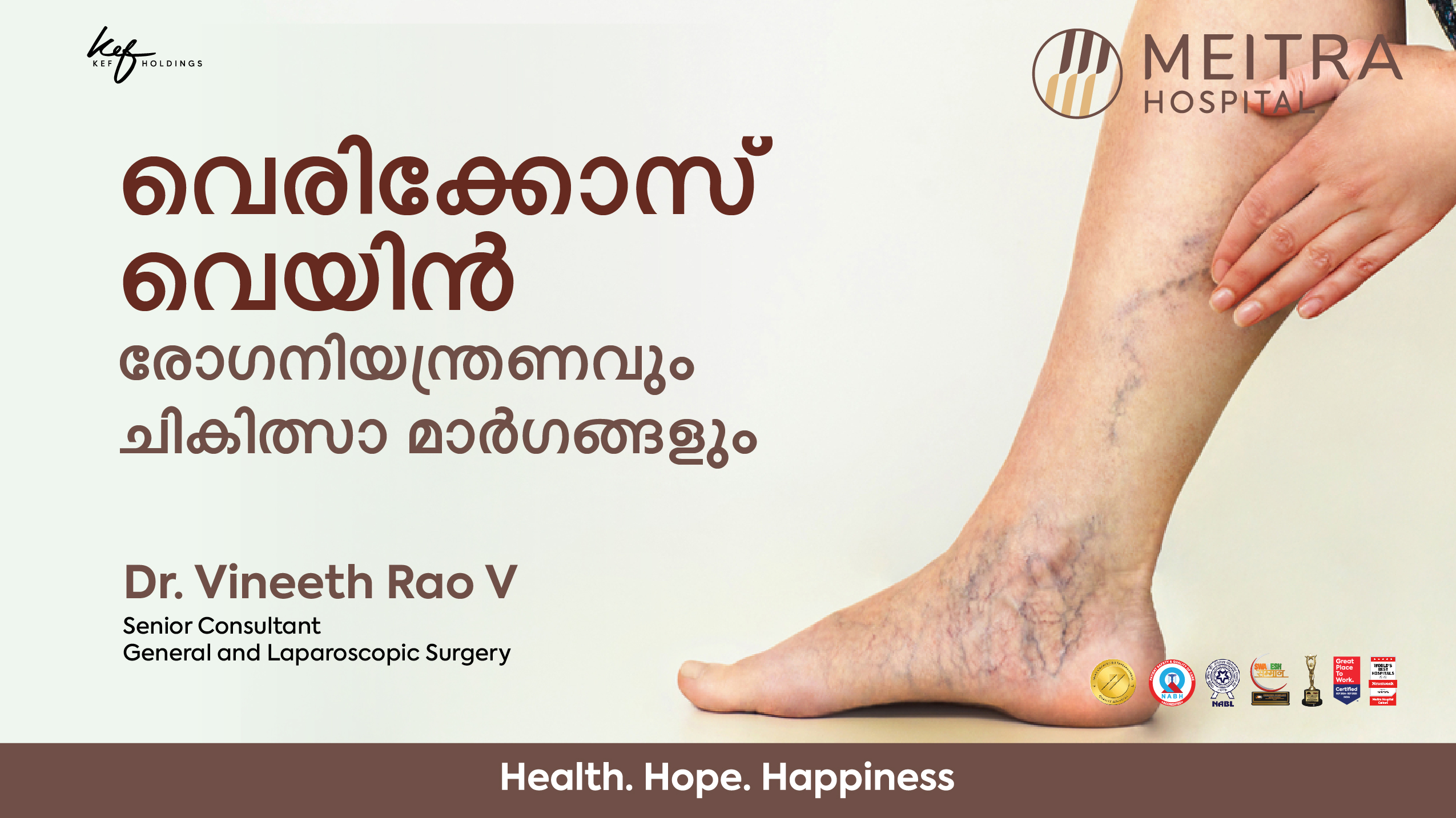 Varicose Veins - Management & Treatment